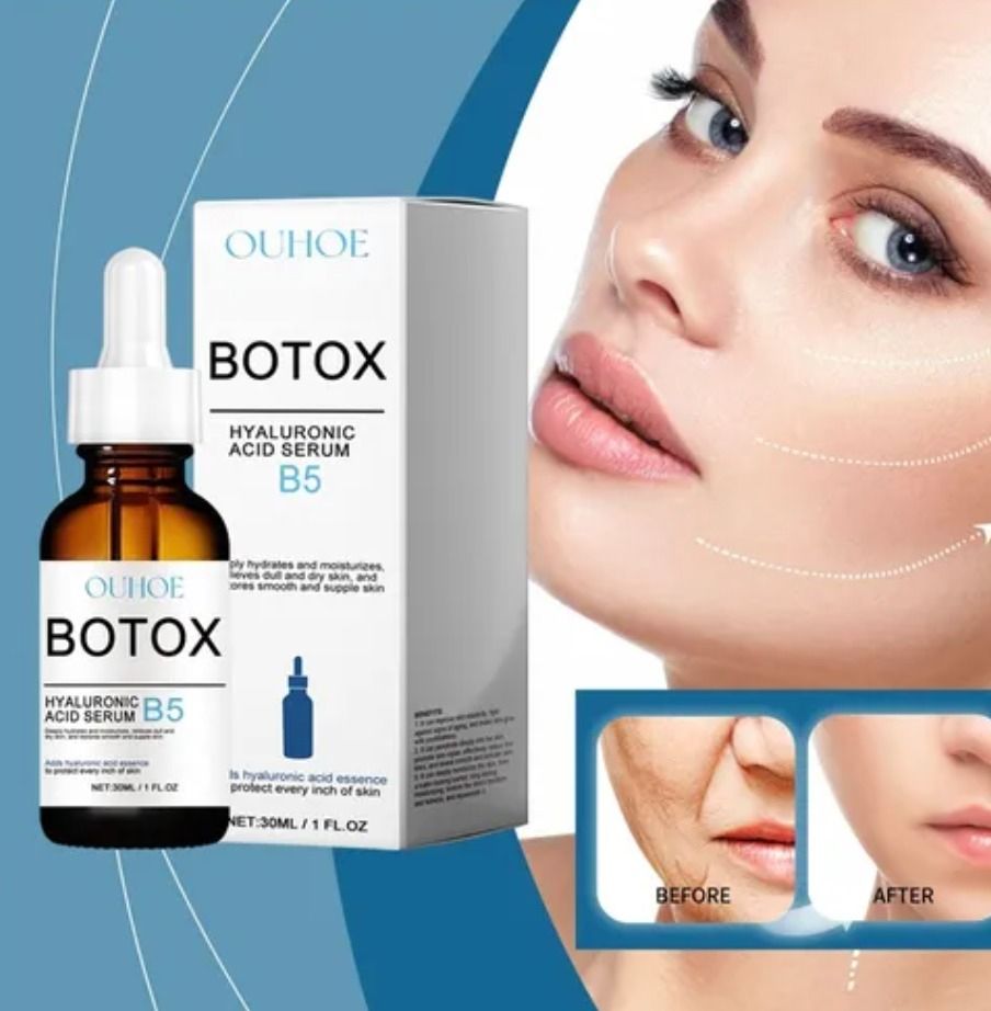 Botox® Con Ácido Hialurónico- PIEL FIRME Y SIN ARRUGAS