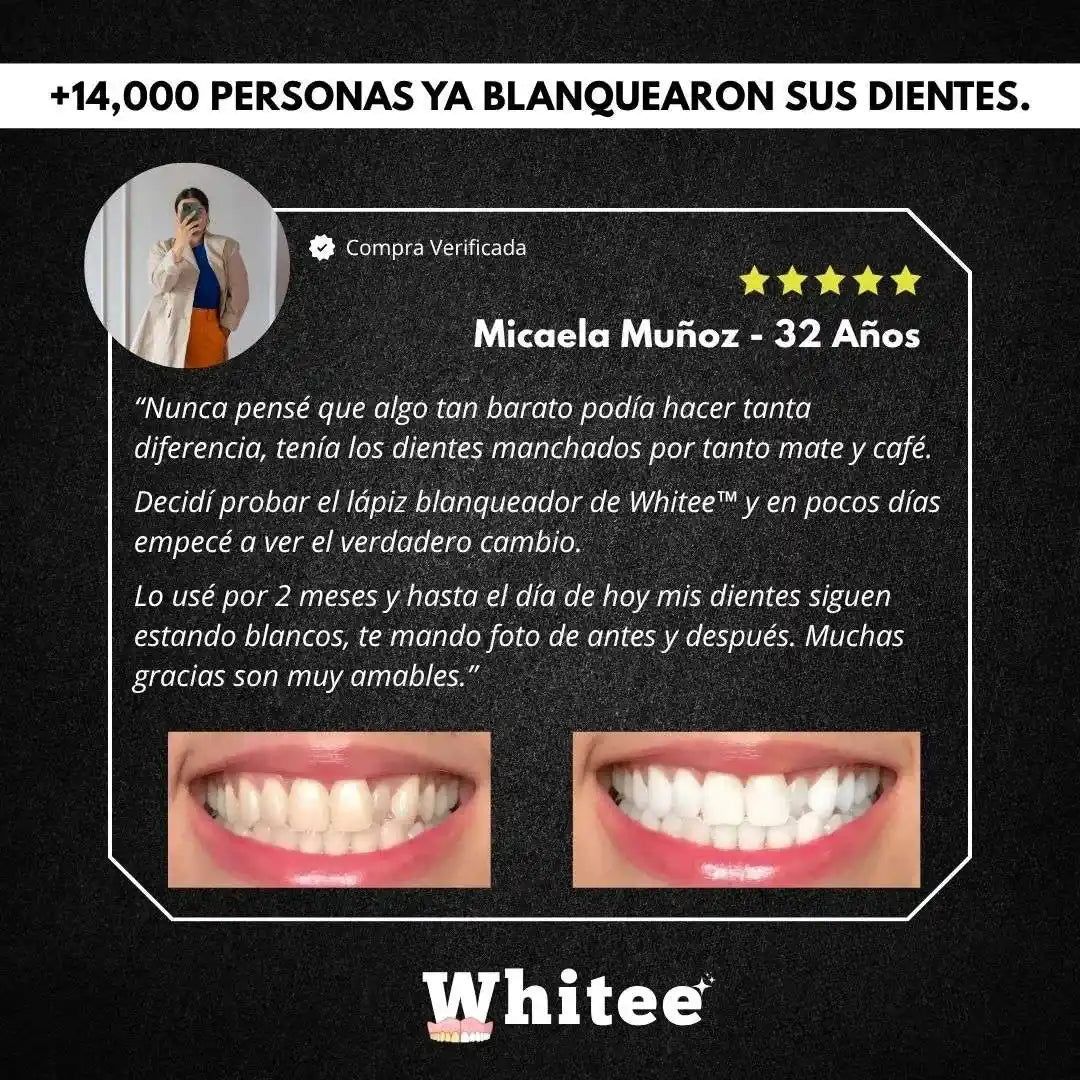Blanqueador Dental™