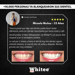 Blanqueador Dental™