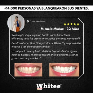 Blanqueador Dental™