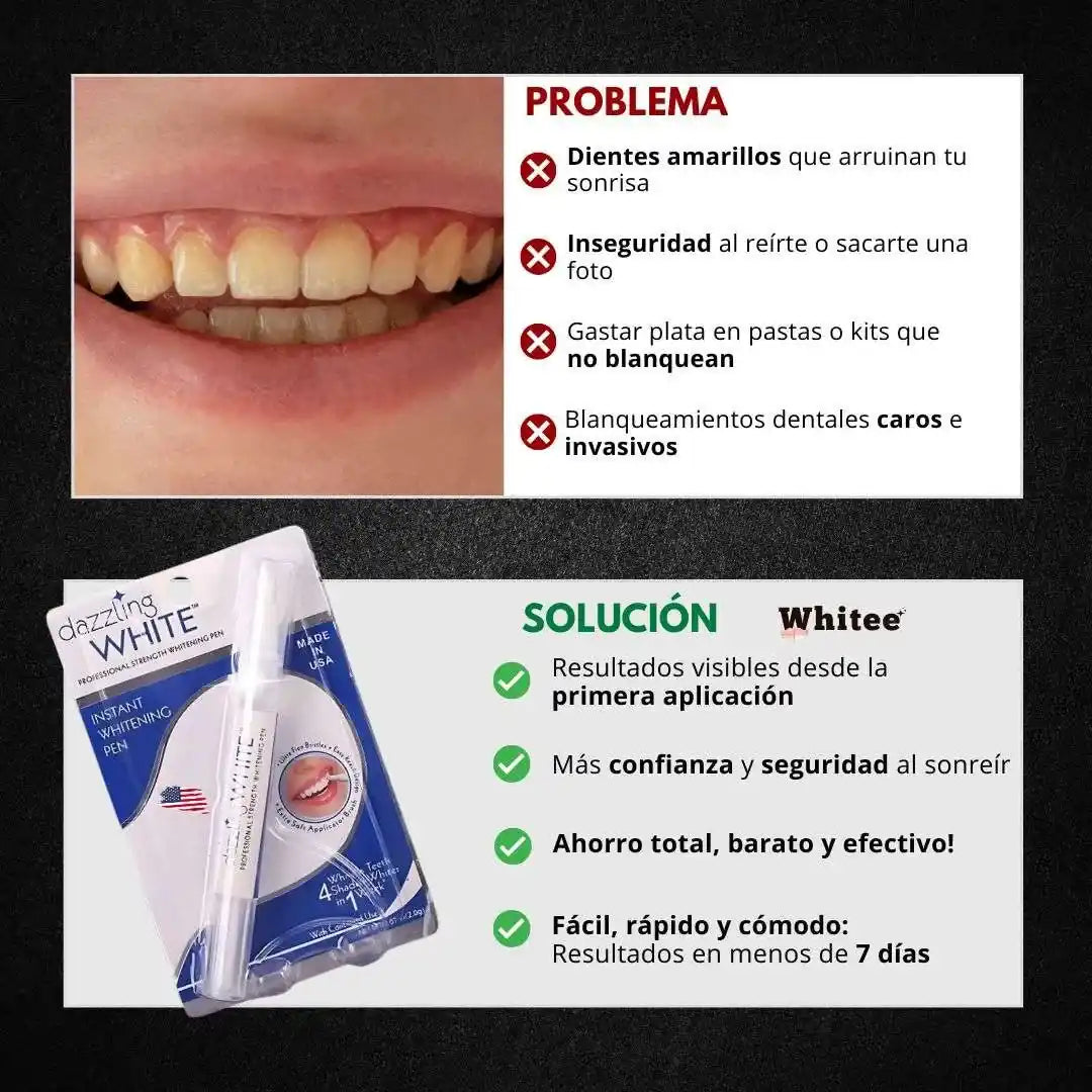 Blanqueador Dental™