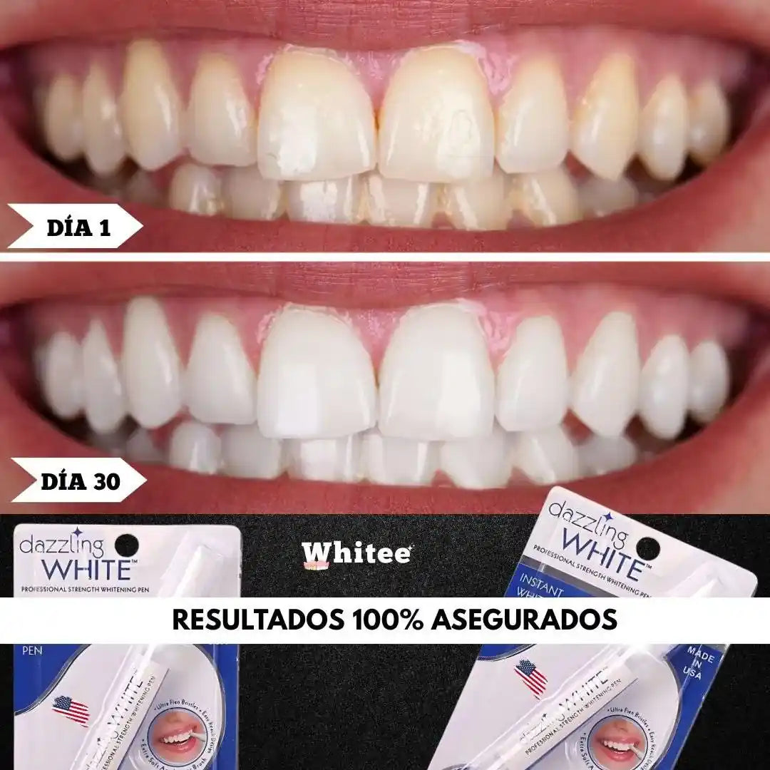 Blanqueador Dental™